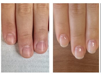 エン(en)/ジェル育成【クリア仕上げ】