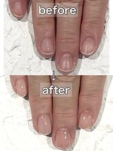 マッシュ MACHELA店(MASHU)/MISA自爪育成