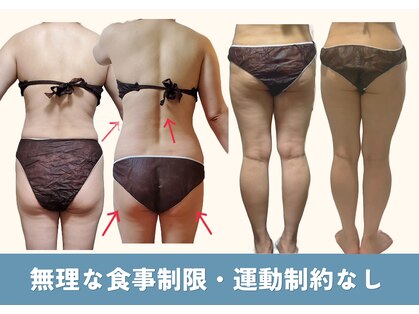 ヨサパーク リノ(YOSA PARK Lino)の写真