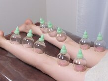 骨美人/カッピング