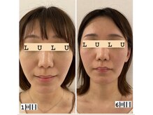ハヌル(hanuru)/小顔ボディ　(hanuru式美容整体)