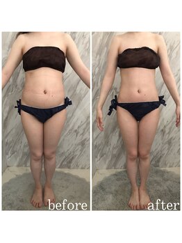 ラニ(LANI)/新型ハイパーナイフ6