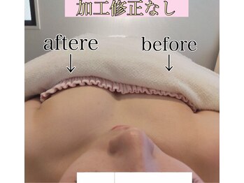 ビルーチェ(BELUCE)/一番人気バストアップ