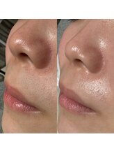 オパール 大阪梅田(op_l)/梅田/眉毛/アイブロウ/眉サロン