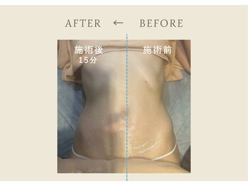 フェリチタトウキョウ(Felicita Tokyo)/インディバBeforeAfter_全身