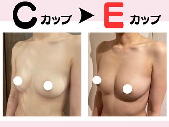 リリ(RILI)/【バストアップ・バストケア】