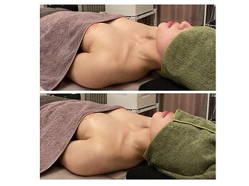 ベンザイ 梅田店(BENZAI)/首のこり、デコルテの削げ、下垂