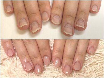 グラシナ なんば店/深爪/噛み/むしり癖/長さ出し