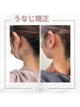ミース 宮崎店/こんなに変わるうなじ矯正