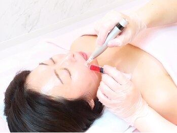 スフィア(Sphere)の写真/【最新美容】脂肪分解REDショット★長年の悩みとおさらば！たるみやホウレイ線改善・小顔が叶う♪