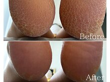 カシェット 広島店(Cachette)/40代女性☆足裏角質ケア90分