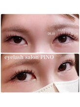 ピノ(PINO)/フラッシュ140本