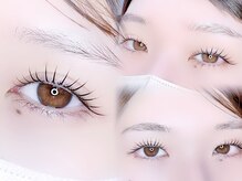 しっかりとカウンセリングを行います◎