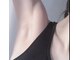 リリー(Lily)の写真/都度払いOK！ルミクス光脱毛で脇も熱くなく、つるスベ肌へ導く◎