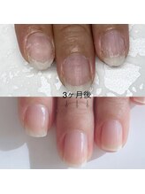 ミミ(mimi)/☆自爪育成☆