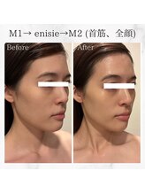 ルピナス(Lupinus)/enisieシリーズ