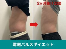 ミスターアンクール 鹿児島(Mr.uncoeur)/自動筋トレ12回後