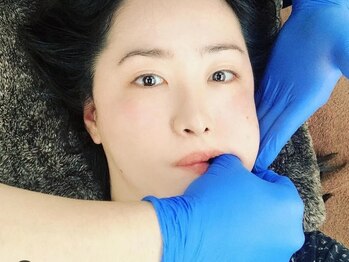 ゆうき式小顔矯正/小顔矯正施術風景