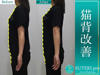 美骨矯正 ステキプロ(SUTEKI pro)/猫背/巻き肩矯正