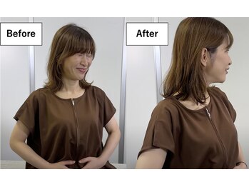 ブレア 銀座/BeforeAfter【鍼灸/カッピング】