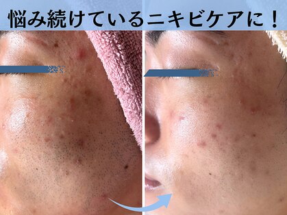 トータルビューティー ココ(Total Beauty CoCo)の写真