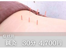 セルフィット鍼灸整骨院/鍼灸30分