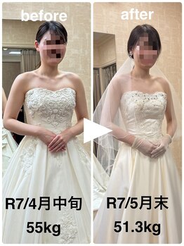 ハッチー(Hacchi)/【20代】エステで美ボディへ！