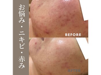 ジェルベーラ(Gerbera)