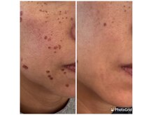 リアウェイク(Reawayke)