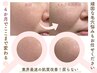 【根本解決したい方へ】コンサル付き☆深層ピーリング× 最新毛穴洗浄¥24,800