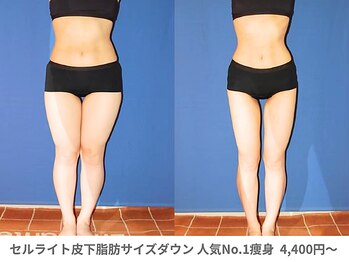 アンシャンテ 芦屋店/医師監修痩身