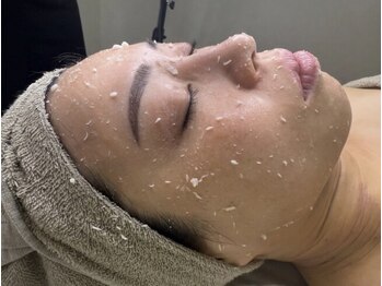 ロイヤル ビューティー サロン(Royal Beauty Saloon)の写真/【韓国セルマンで肌質管理×ピーリング】美白ケア効果◎ナイアシドアミド配合水分量UP/ニキビケア/毛穴レス