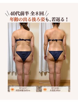 ユナリ(yunari)/40代前半｜Before・After…１