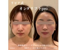 リビア(LIVIA)の雰囲気(最新マシン・オンダリフトpro☆痛みやダウンタイムなし)