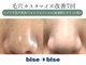 ビズビズ 天王寺店(bisebise)の写真/夏の毛穴リセット！【医療提携】毛穴黒ずみ詰まり/角栓/いちご鼻/毛穴開き/頬たるみ毛穴に特化した毛穴専門