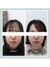 美人ヶ丘/自由が丘,小顔矯正,マッサージ