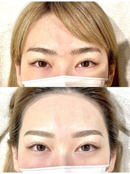 ラ ベール メール(La belle mer)/アイブロウ（before after）