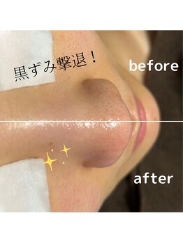 ファウンデーション(FOUNDATION)/