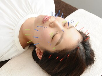 やけの鍼灸整骨院/美容鍼