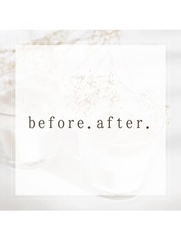 ヨサパーク エトワール 聖蹟桜ヶ丘店(YOSAPARK)/before.after☆