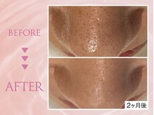 クリアラボ 川崎(Clear Lab)/韓国式肌管理&毛穴洗浄専門店