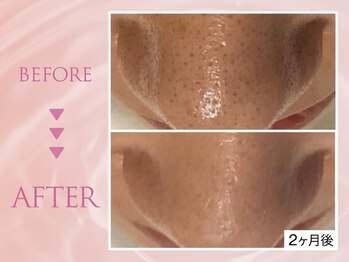 クリアラボ 川崎(Clear Lab)/韓国式肌管理&毛穴洗浄専門店