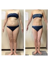 ビボディラボ 海老名店(美Body Labo)/下腹部101.5→78.0cm(23.5cm) &nbsp;