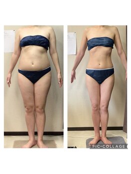 ビボディラボ 海老名店(美Body Labo)/下腹部101.5→78.0cm(23.5cm) &nbsp;