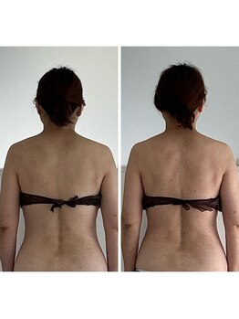 シューライフ(Syu-Life)/５０代女性/首肩こり