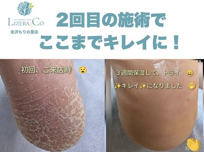 リゼラアンドコー 金沢もりの里店(LIZERA&Co)の写真