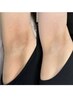 ローマピンク★【脇】モニター限定 40%OFF！アフタークリーム3本付き◎