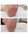 【フットケア】