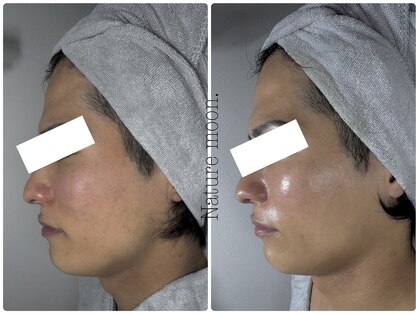 ナチュールムーン(Nature moon.)の写真