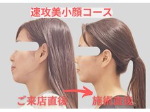 エンジェル(Angel)の雰囲気(小顔×骨格専門サロン/小顔骨格ボディメイク¥10000)